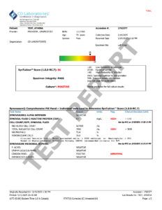 Synovasure Comp PJI Panel w SynTuition_Sample Report